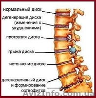Профессиональный массаж: остеохондроз, антицел. программы, массаж лица - <ro>Изображение</ro><ru>Изображение</ru> #2, <ru>Объявление</ru> #1478172