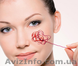 Лазерное удаление сосудистой сетки,  звездочек