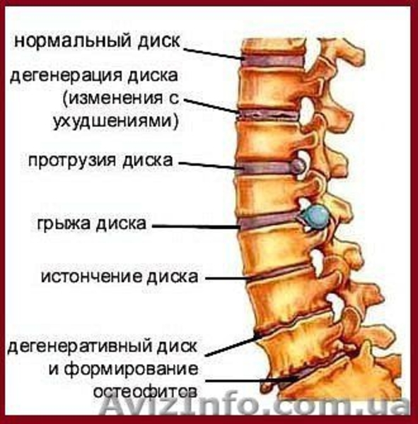 Профессиональный массаж: остеохондроз, антицел. программы, массаж лица - <ro>Изображение</ro><ru>Изображение</ru> #2, <ru>Объявление</ru> #1478172